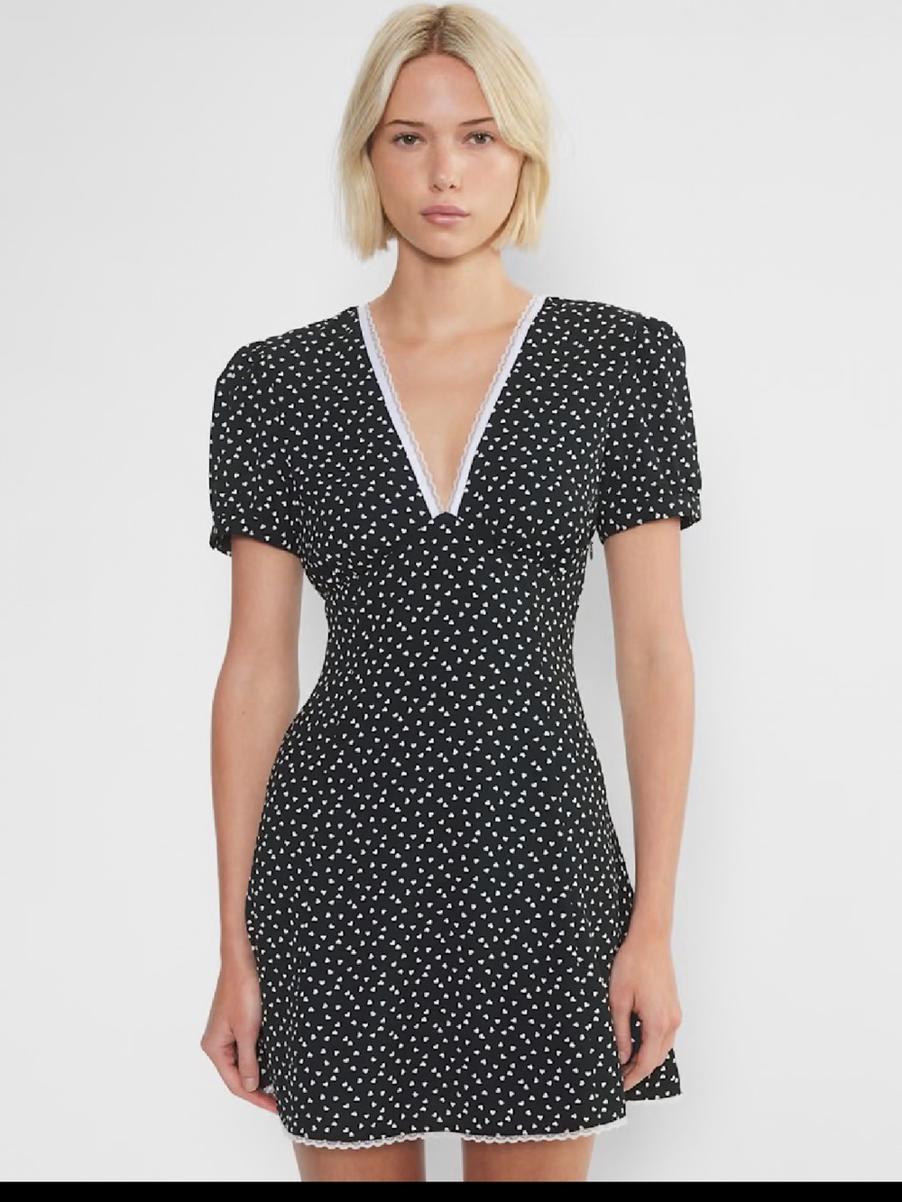 Aritzia Lace Trim Mini Dress